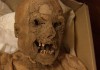 Мумия развенчала миф о связи между техническим прогрессом и раком
