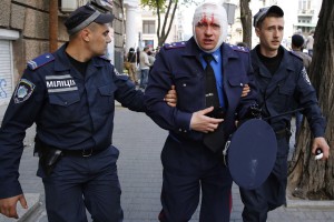 2 мая 2014 года. Одесса. Раненный сотрудник милиции, пострадавший во время уличных столкновений. Фотография: REUTERS/Yevgeny Volokin
